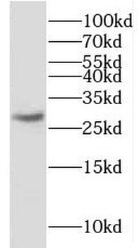 KLK2 Rabbit Polyclonal Antibody