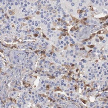 KLK2 Rabbit Polyclonal Antibody