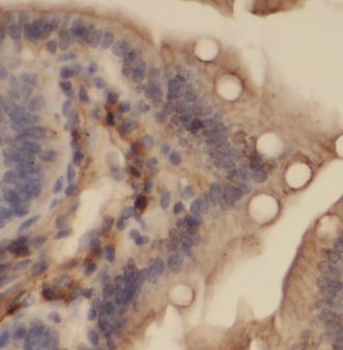 KANK2 Rabbit Polyclonal Antibody