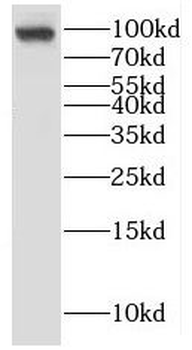 KANK2 Rabbit Polyclonal Antibody