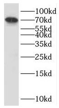 KARS1 Rabbit Polyclonal Antibody
