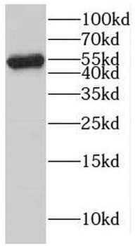 KATNAL1 Rabbit Polyclonal Antibody