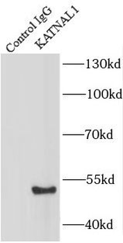KATNAL1 Rabbit Polyclonal Antibody