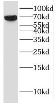 KLHL41 Rabbit Polyclonal Antibody