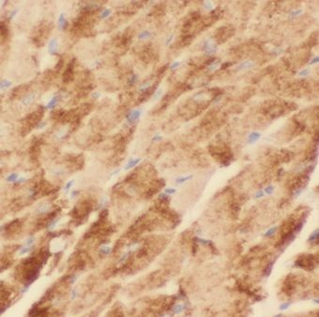 KLHL41 Rabbit Polyclonal Antibody