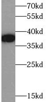 KCNAB2 Rabbit Polyclonal Antibody