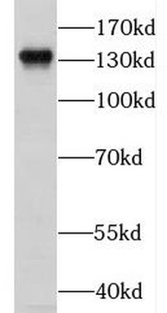 KCNH7 Rabbit Polyclonal Antibody