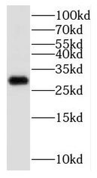 KCNIP3 Antibody