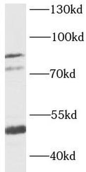 KCNN3 Rabbit Polyclonal Antibody