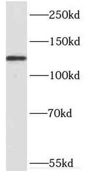KDM2A Antibody