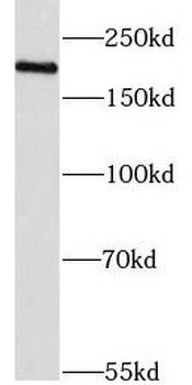 KDM3B Rabbit Polyclonal Antibody
