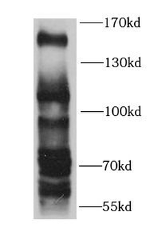 KDM4A Rabbit Polyclonal Antibody