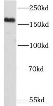 KDM5C Rabbit Polyclonal Antibody