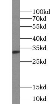 KHK Rabbit Polyclonal Antibody