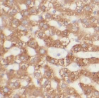 KHK Rabbit Polyclonal Antibody