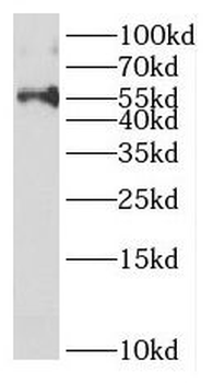 DELE1 Rabbit Polyclonal Antibody