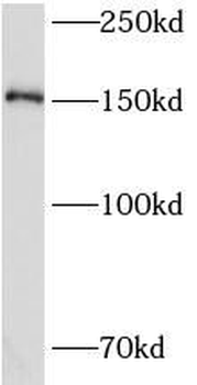 CEMIP Rabbit Polyclonal Antibody