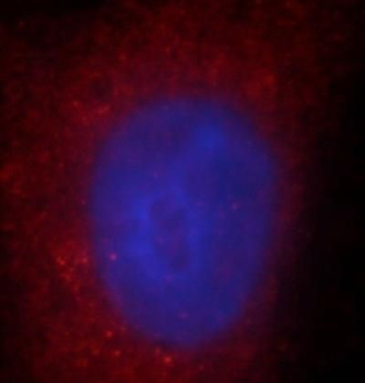 CEMIP Rabbit Polyclonal Antibody