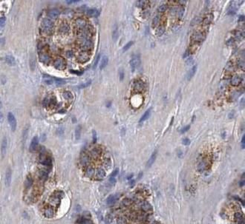 CEMIP Rabbit Polyclonal Antibody