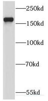 KIF17 Rabbit Polyclonal Antibody
