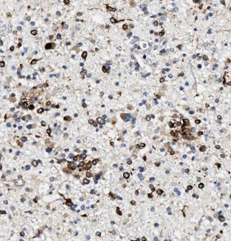 KIF17 Rabbit Polyclonal Antibody