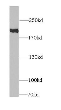 KIF1B Rabbit Polyclonal Antibody