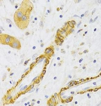 KIF1B Rabbit Polyclonal Antibody