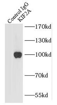 KIF2A Rabbit Polyclonal Antibody