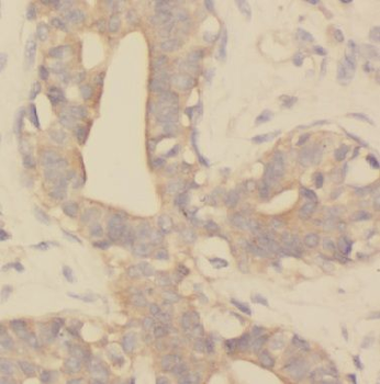 KIF2A Rabbit Polyclonal Antibody