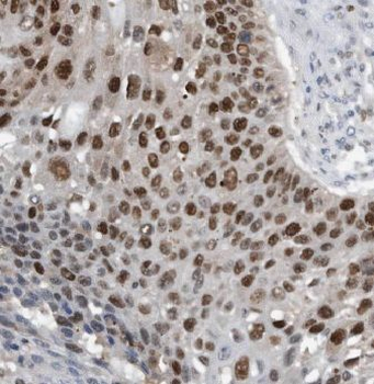 KIF4A Rabbit Polyclonal Antibody