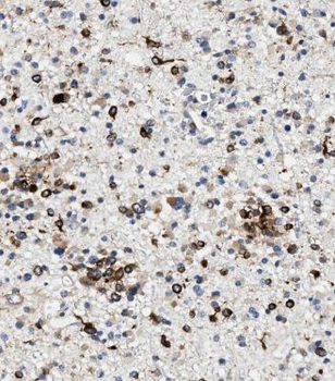 KIFAP3 Rabbit Polyclonal Antibody
