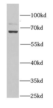 KLC1 Rabbit Polyclonal Antibody