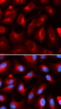 KLC1 Rabbit Polyclonal Antibody