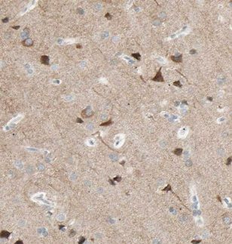 KLC1 Rabbit Polyclonal Antibody