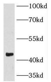 KLF17 Rabbit Polyclonal Antibody