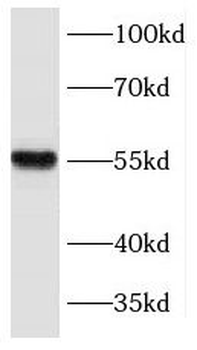 KLF5 Rabbit Polyclonal Antibody