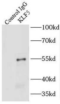 KLF5 Rabbit Polyclonal Antibody