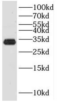 KLK3 Rabbit Polyclonal Antibody