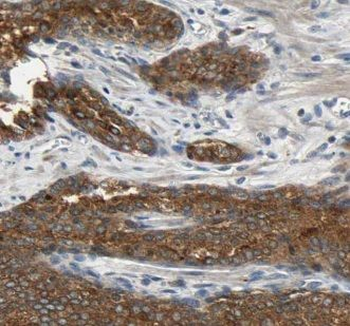 KLK3 Rabbit Polyclonal Antibody