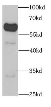 KPNA1 Rabbit Polyclonal Antibody