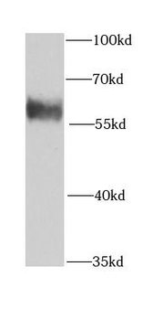KPNA6 Rabbit Polyclonal Antibody