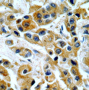 KRT10 Rabbit Polyclonal Antibody