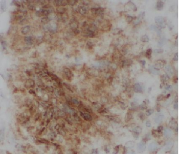 KRT23 Antibody