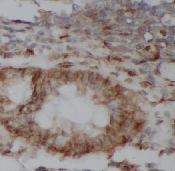 KRT81 Rabbit Polyclonal Antibody