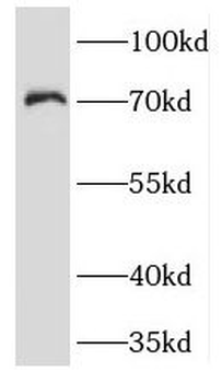 KCNA2 Rabbit Polyclonal Antibody