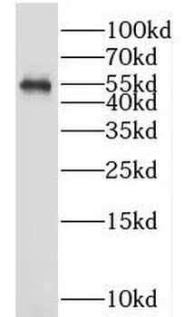 LTF Rabbit Polyclonal Antibody