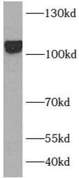 LAMP2 Antibody