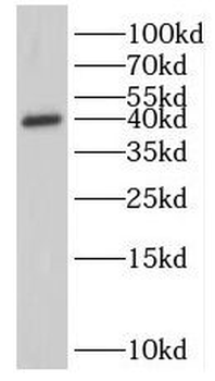CD207 Rabbit Polyclonal Antibody