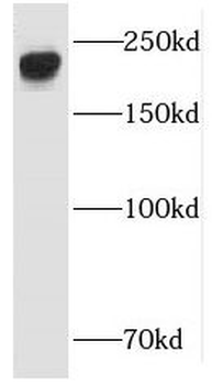 ARHGEF12 Rabbit Polyclonal Antibody