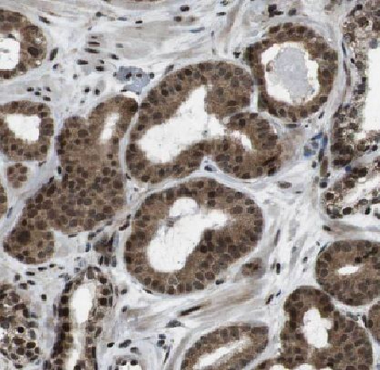 ARHGEF12 Rabbit Polyclonal Antibody